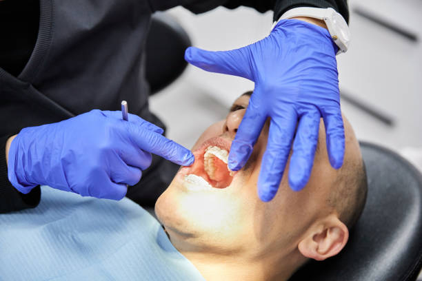 Best Knocked-Out Tooth (Avulsed Tooth) Treatment in Gladstone, MO