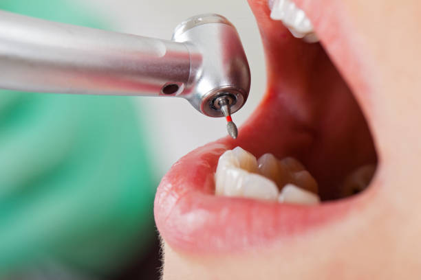 Best Dental Abscess Treatment in Gladstone, MO